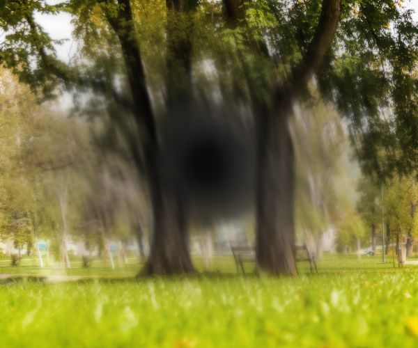 Macular Degeneration Testing Bayside Eyecare