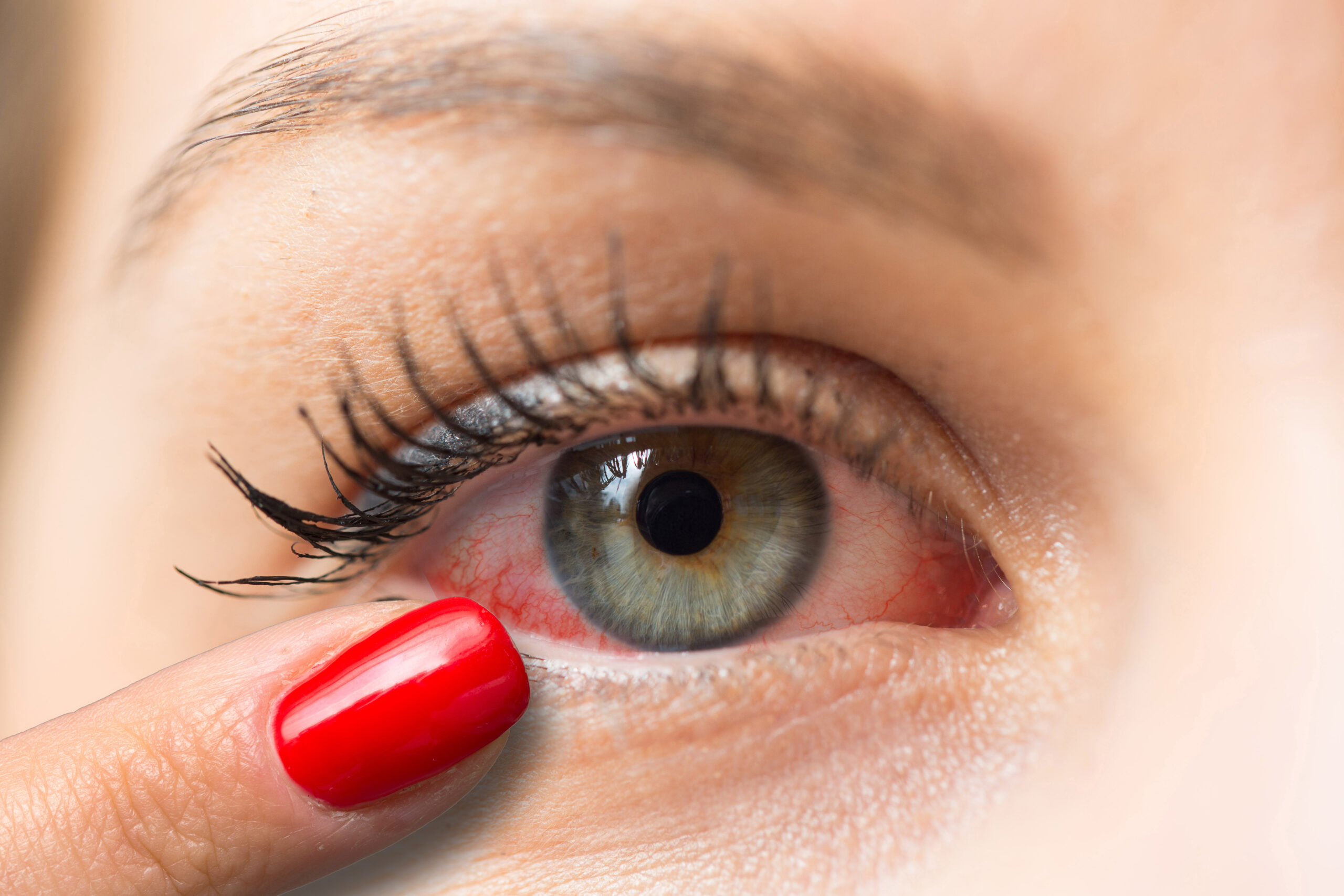 Eye Infection, Red Or Injured Eye? When To See An Optometrist Vs GP